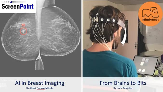 AI for breast cancer detection + Typing with your brain for ALS patients